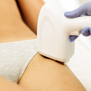 Depilación laser pamplona